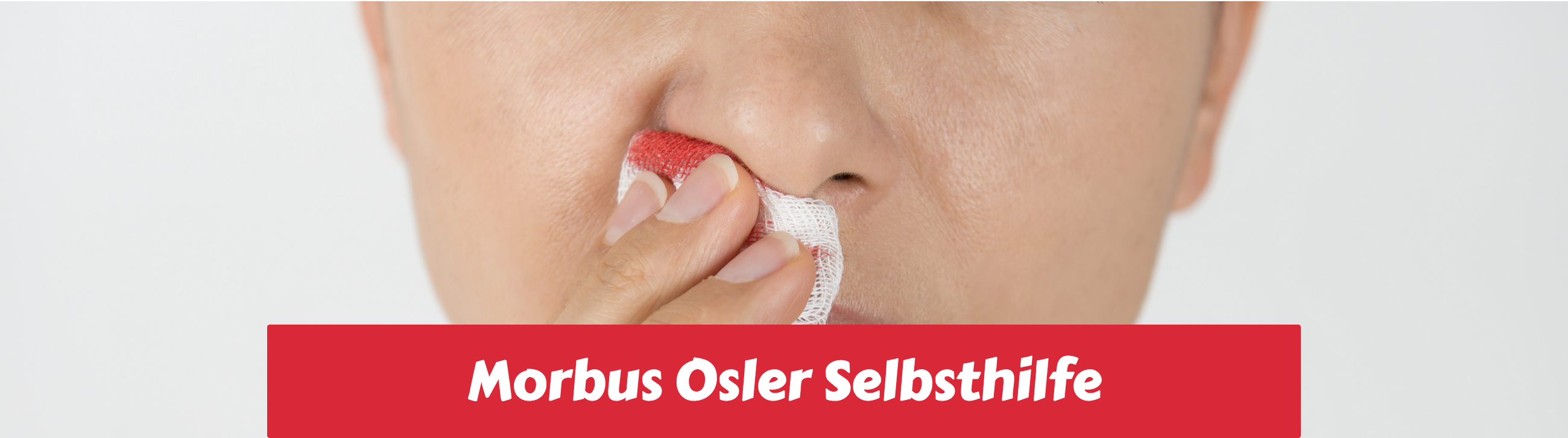 Morbus Osler Selbsthilfe